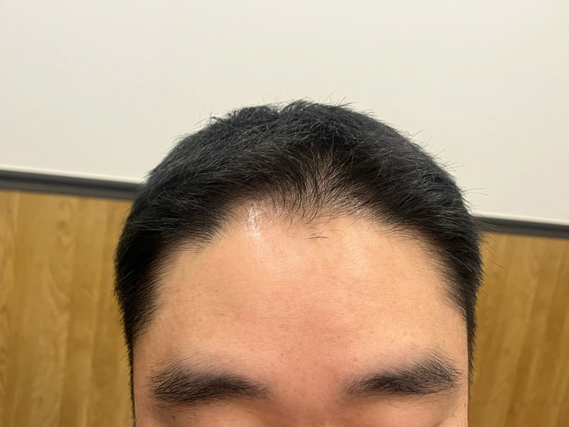 비포 1.jpg
