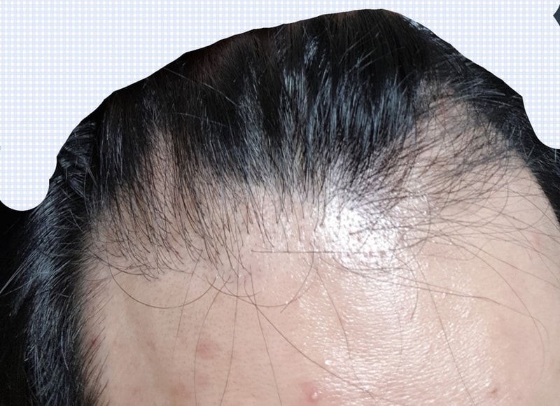 KakaoTalk_2017-11-21-20-29-28_Photo_18.jpg