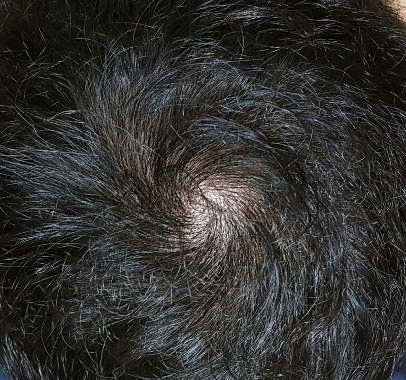 20170809_023057.jpg