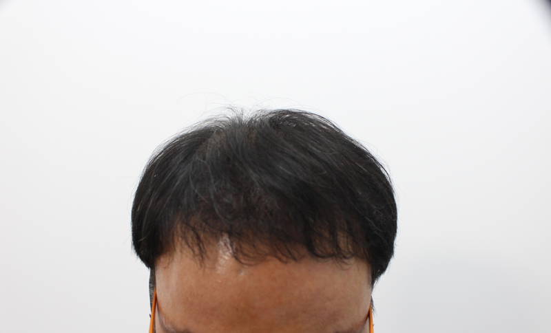 8개월 정면.png