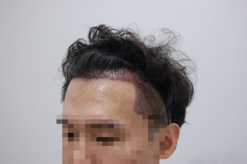 좌측.jpg