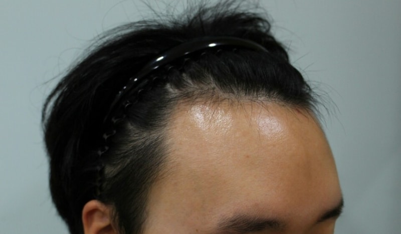 수술전2.jpg