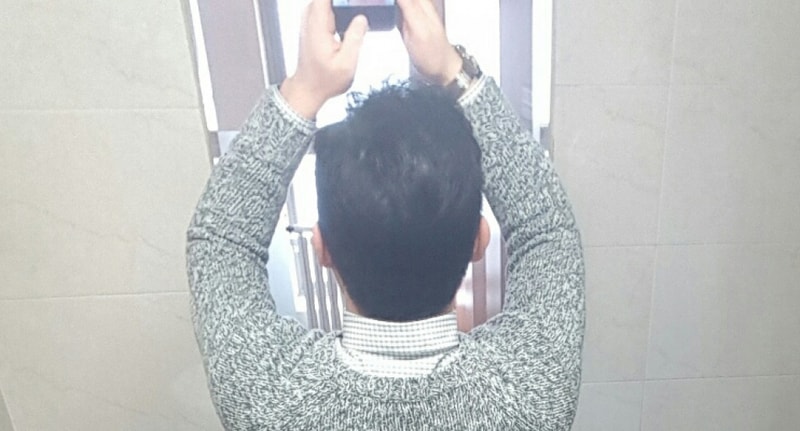 수술후2년(2).jpg