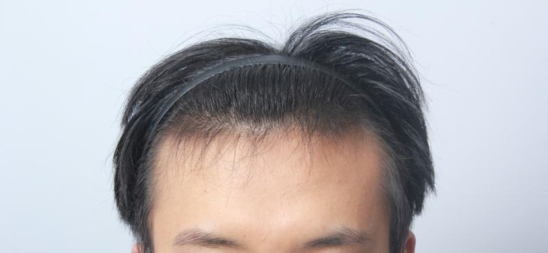 수술전 3.jpg