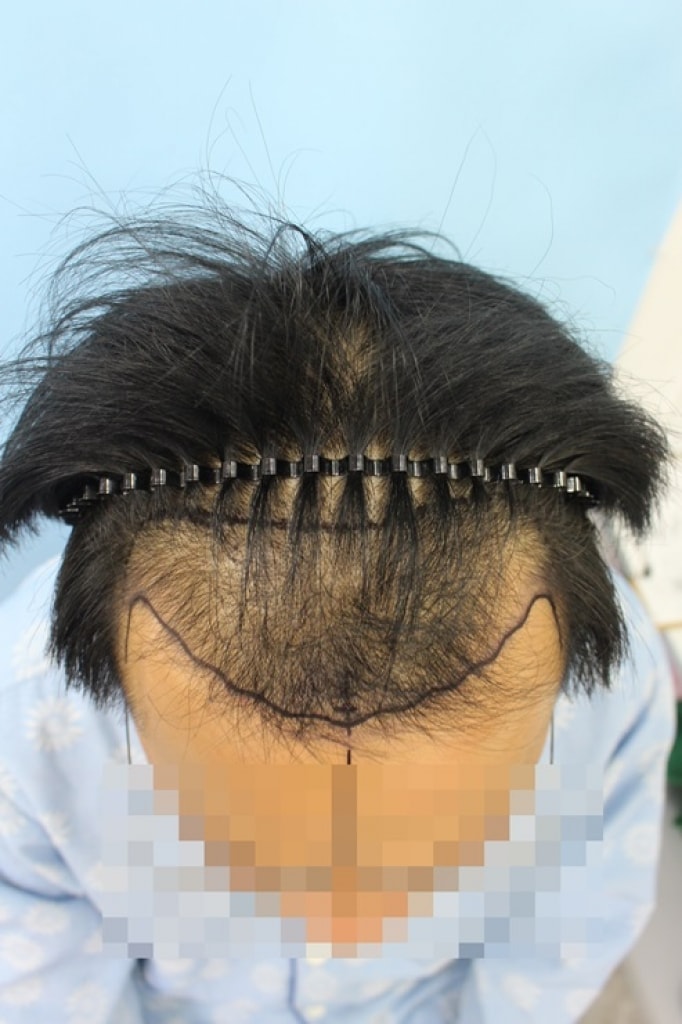 수술전_1.jpg