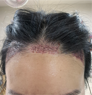 포토후기 이미지