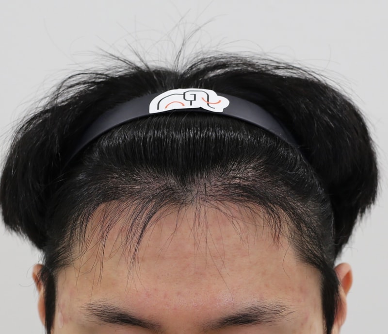 7개월 경과.jpg