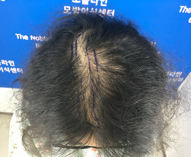 조금 더디지만 잘 자라고 있어요.