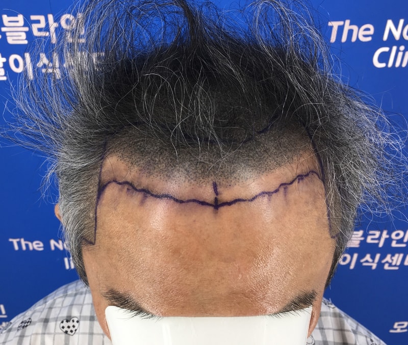 처음 후기 씁니다. 6개월 입니다.
