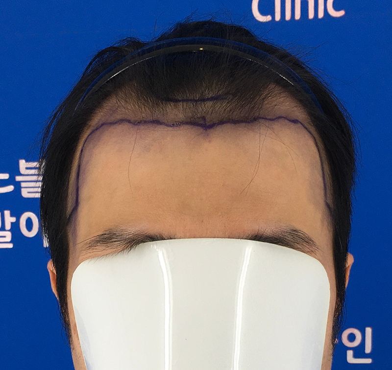 포토후기 이미지