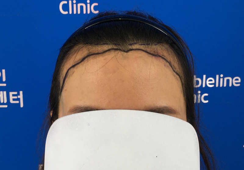 의사 선생님이 밀착케어 해주셔서 정말 좋습니다.