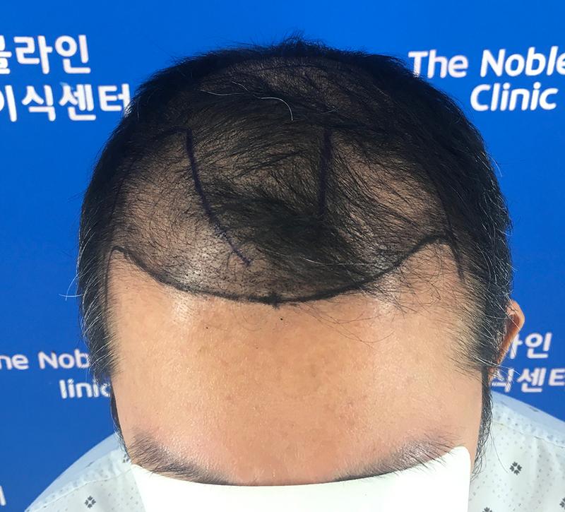 KakaoTalk_20250616_164519074_03.jpg