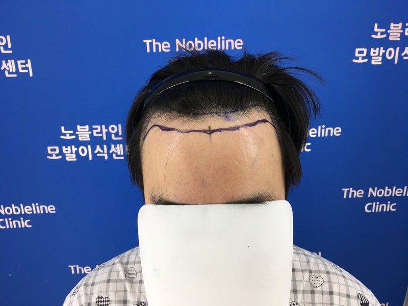 암흑기 입니다. ㅜㅜ