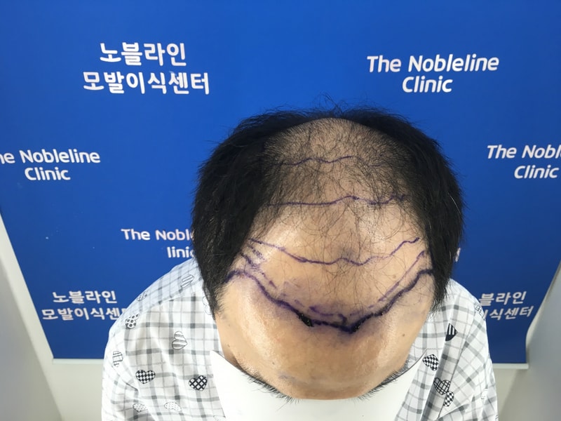 포토후기 이미지