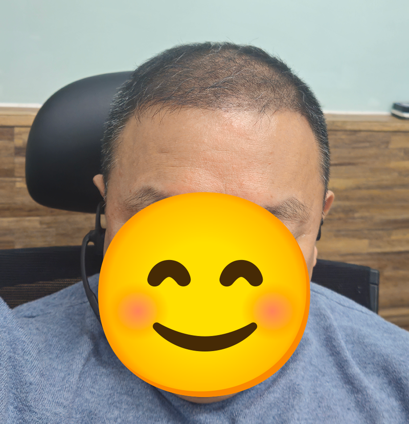 第27年假发逃脱80天后期
