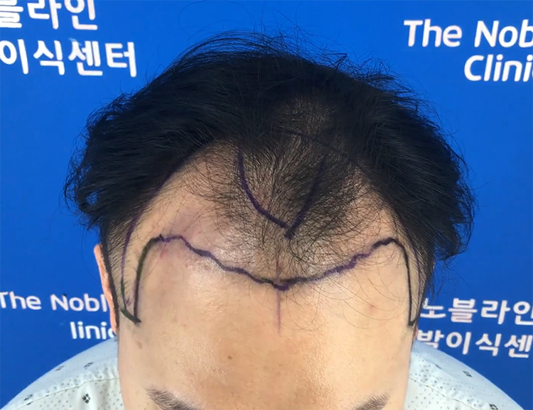 졸업 후 6개월 경과 입니다. (14개월) 여러분 노블라인 꼭 가세요!!