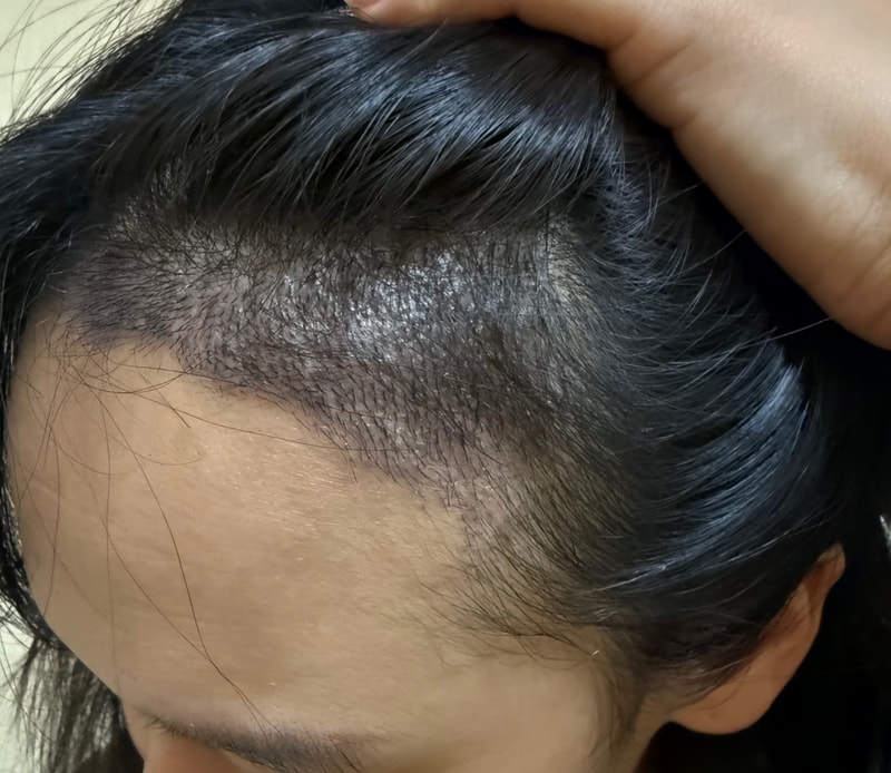 결혼 앞두고 심어버렸어요!