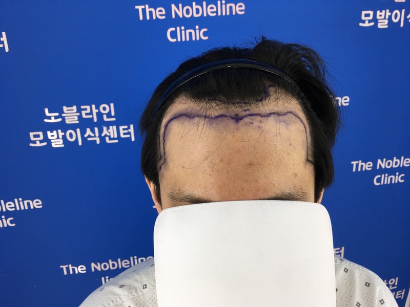 포토후기 이미지