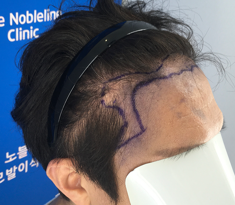 포토후기 이미지