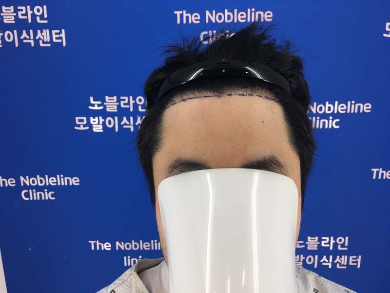 노블라인에서 밀도보강 했습니다.