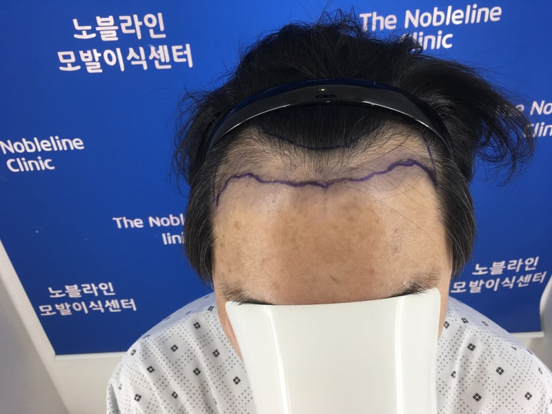 드디어 머리가 자라나고 있습니다!