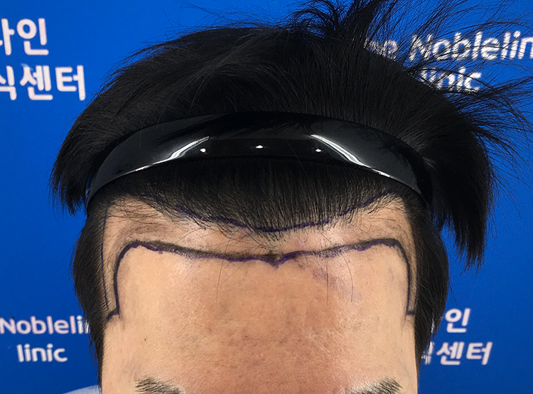 포토후기 이미지