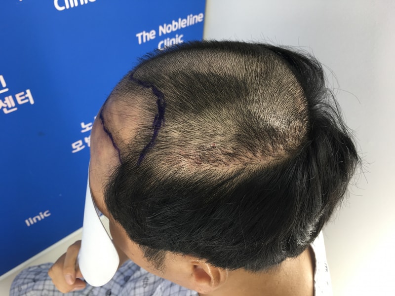 포토후기 이미지