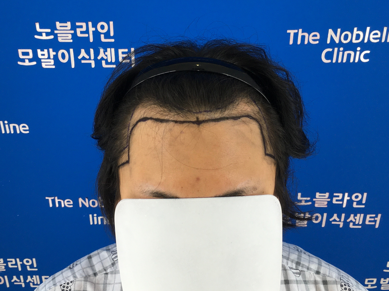 노블라인에서 엠자 심었습니다.