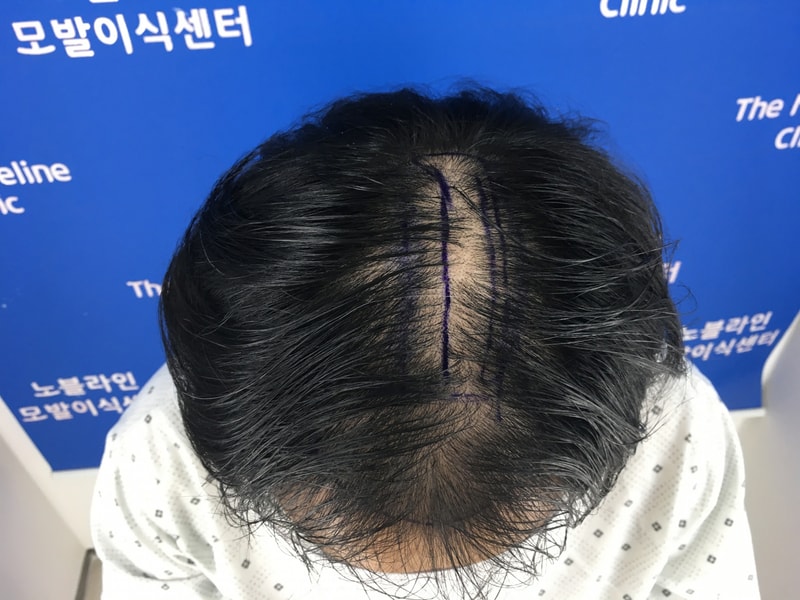 포토후기 이미지