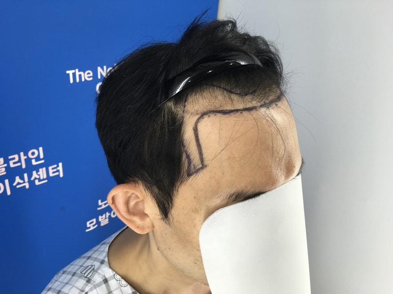 노블라인은 잘 못할 수가 없는 병원입니다.