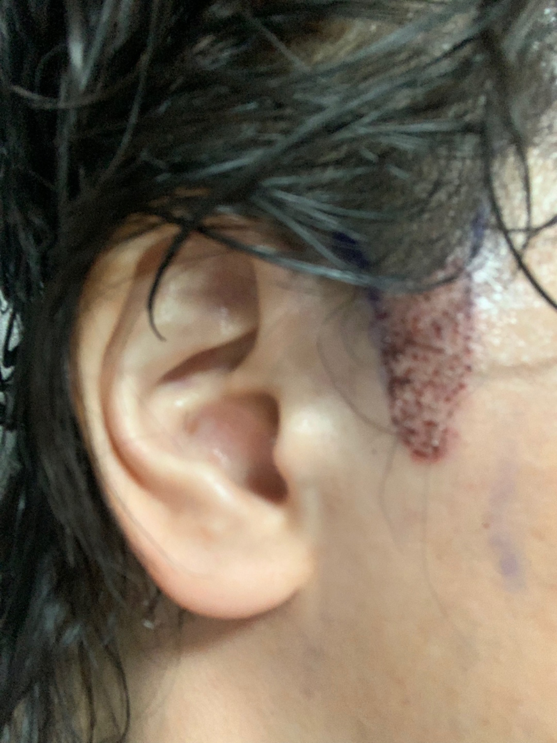 Day 10 of the Novline Surgery