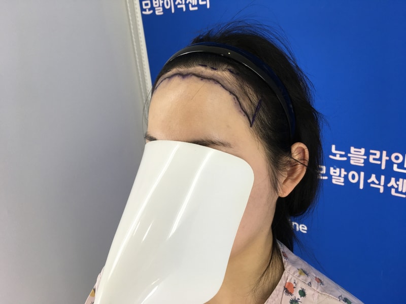 헤어라인 강추 해요!!