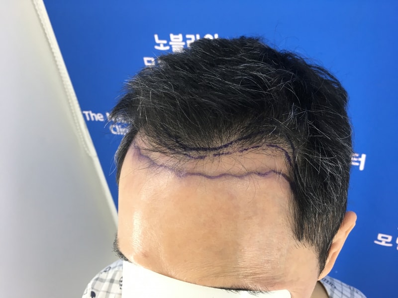 포토후기 이미지