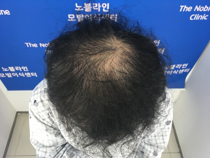 포토후기 이미지