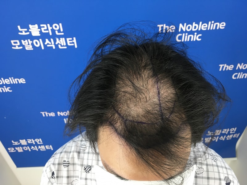 포토후기 이미지
