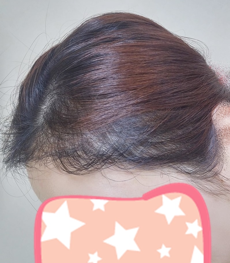 KakaoTalk_20170803_131445051.jpg