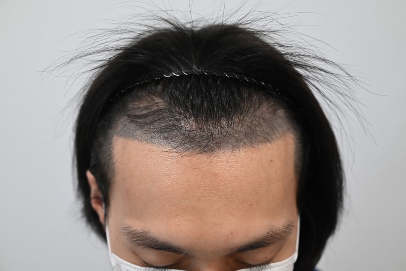 수술전.jpg