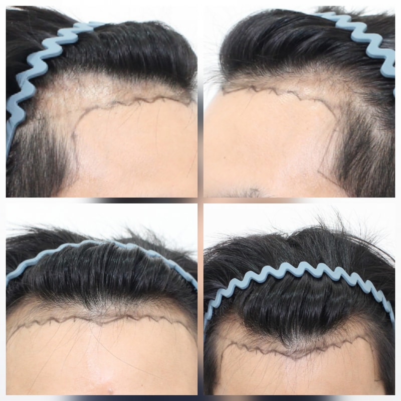 포토후기 이미지