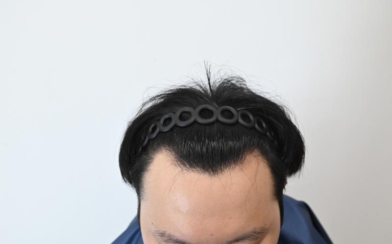 비절개 히든컷 3200모