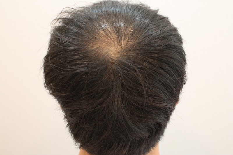 Before.jpg
