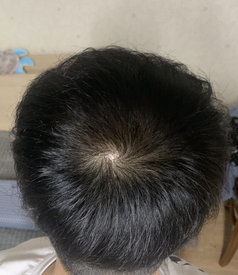 AFTER 7month.jpg