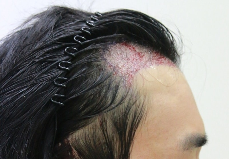 수술후2.JPG