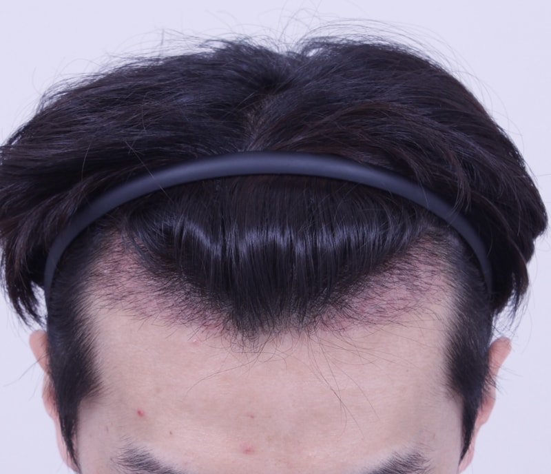 3주1.JPG