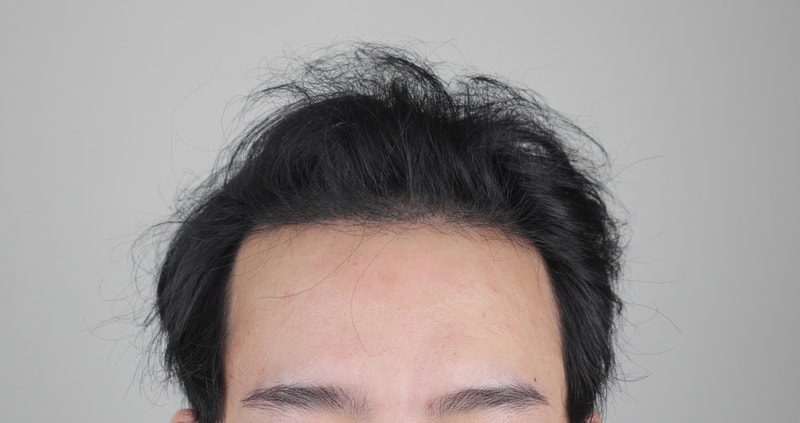 정면 후.jpg