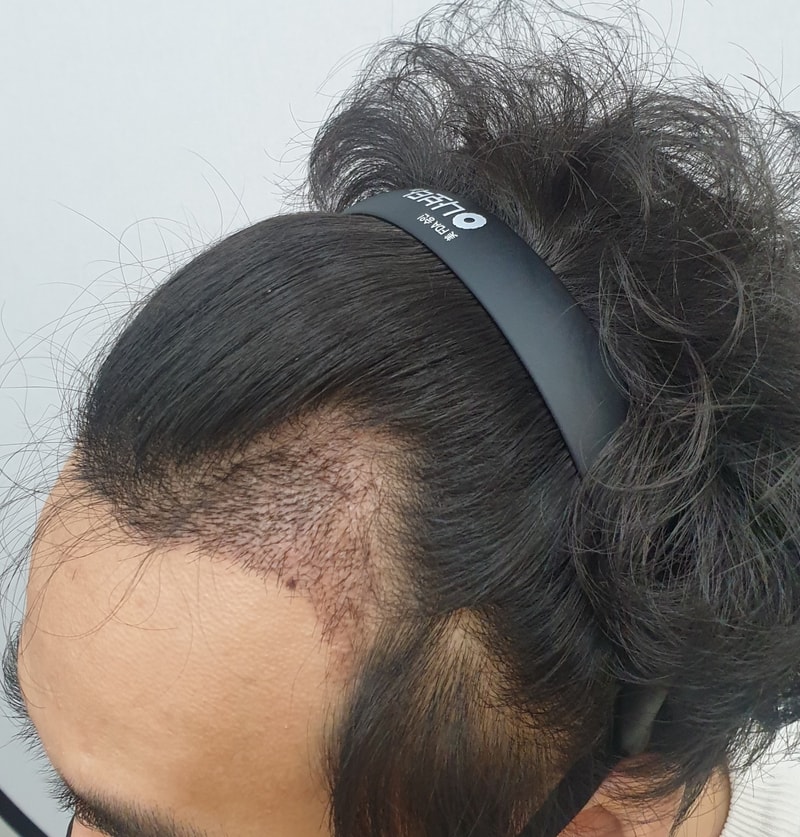 왼쪽.jpg