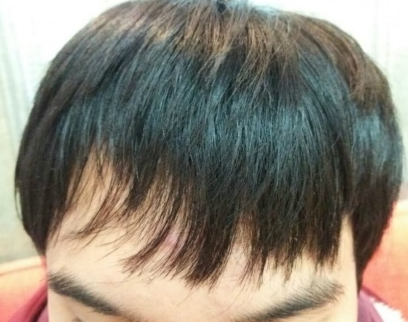 후2.jpg