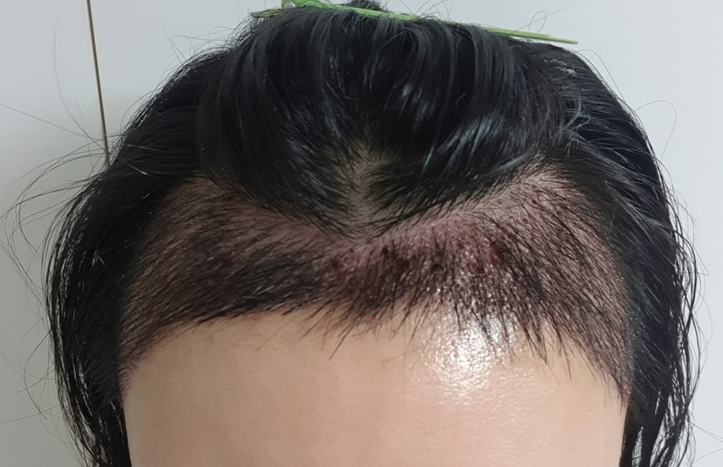 정면상위2일차.jpg