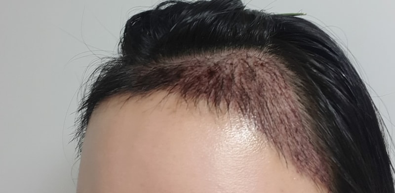 좌측2일차.jpg