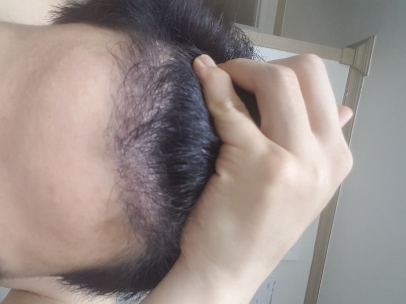 虽然是4个月后期 但感觉不太好