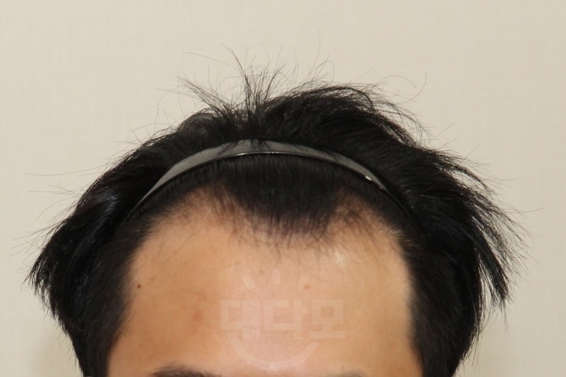 전2.jpg